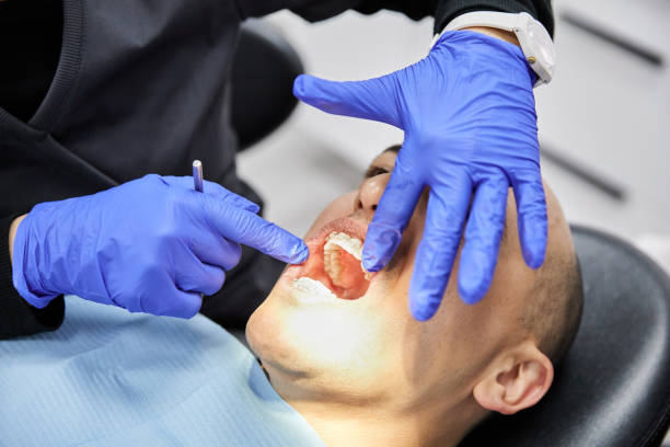 Best Emergency Dental Care for Broken or Chipped Teeth in Hunters Creek Village, TX